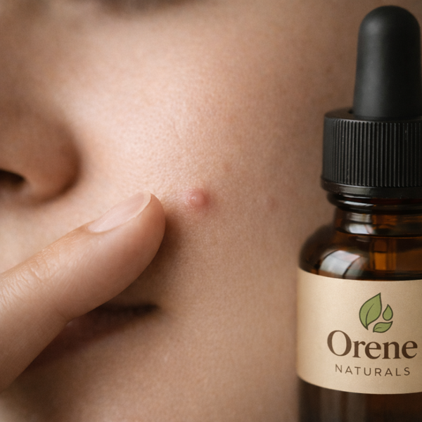 <strong>Target</strong>